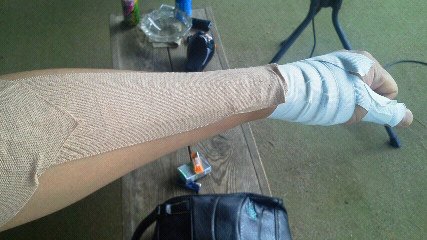 「長男の腕の写真」